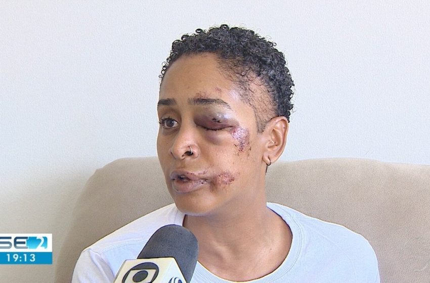  Mulher tem rosto desfigurado durante briga em lanchonete em Aracaju e denuncia homofobia